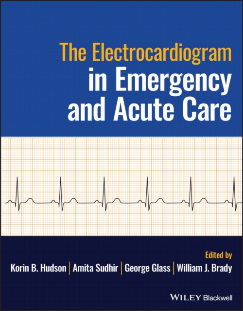 The Electrocardiogram in Emergency and Acute Care, EPUB eBook