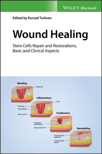 Wound Healing : Stem Cells Repair and Restorations, Basic and Clinical Aspects, PDF eBook