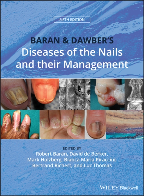 Baran and Dawber's Diseases of the Nails and their Management, Hardback Book