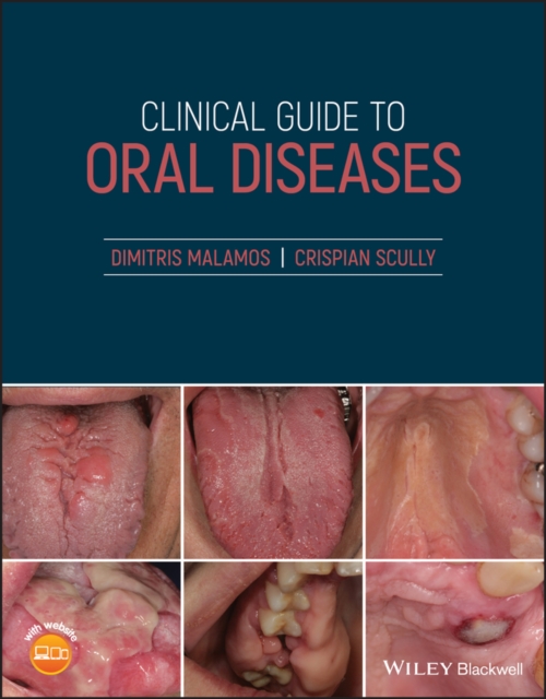 Clinical Guide to Oral Diseases, PDF eBook