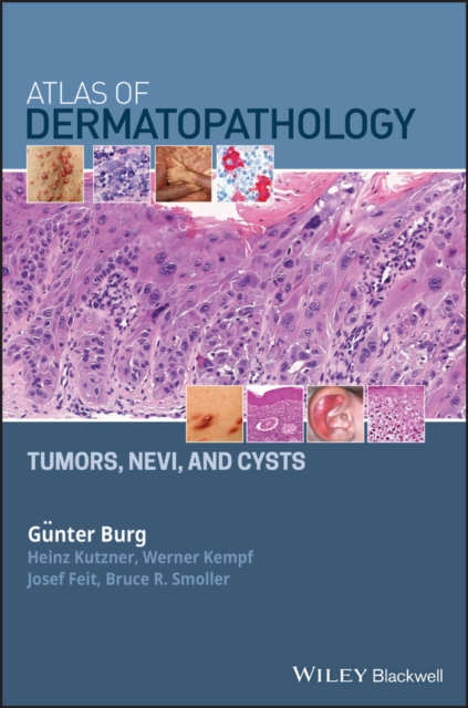 Atlas of Dermatopathology : Tumors, Nevi, and Cysts, PDF eBook