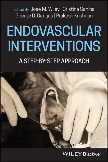 Endovascular Interventions : A Step-by-Step Approach, Paperback / softback Book