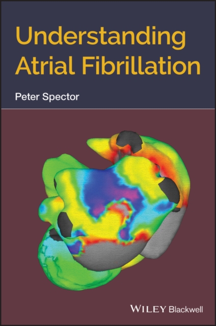 Understanding Atrial Fibrillation, Paperback / softback Book