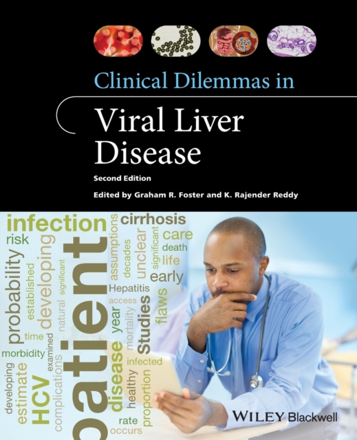 Clinical Dilemmas in Viral Liver Disease, Paperback / softback Book