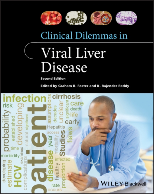 Clinical Dilemmas in Viral Liver Disease, EPUB eBook