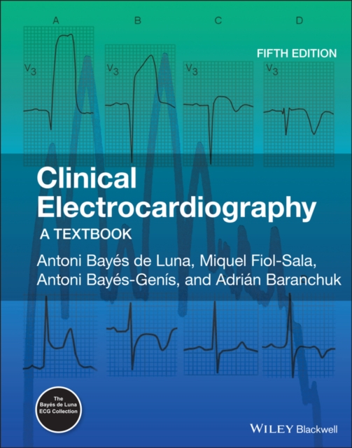 Clinical Electrocardiography : A Textbook, Hardback Book