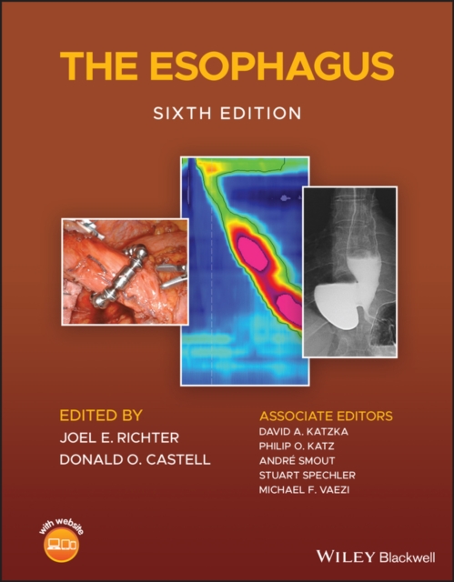 The Esophagus, Hardback Book