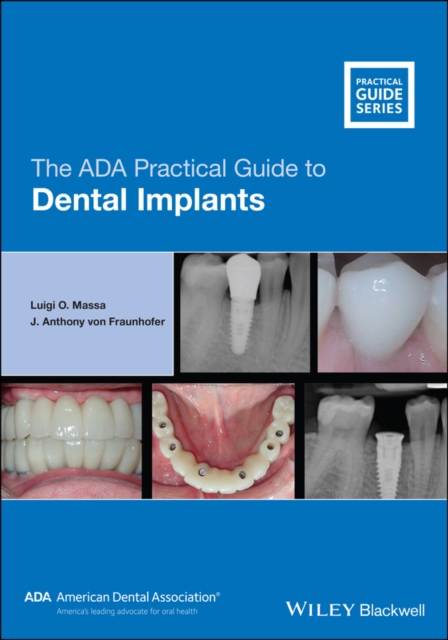 The ADA Practical Guide to Dental Implants, PDF eBook
