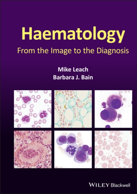Haematology : From the Image to the Diagnosis, PDF eBook
