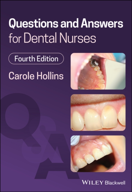 Questions and Answers for Dental Nurses, Paperback / softback Book