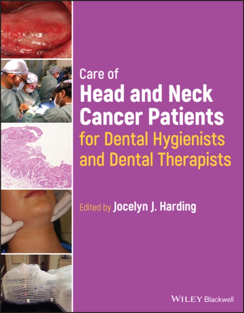 Care of Head and Neck Cancer Patients for Dental Hygienists and Dental Therapists, Paperback / softback Book