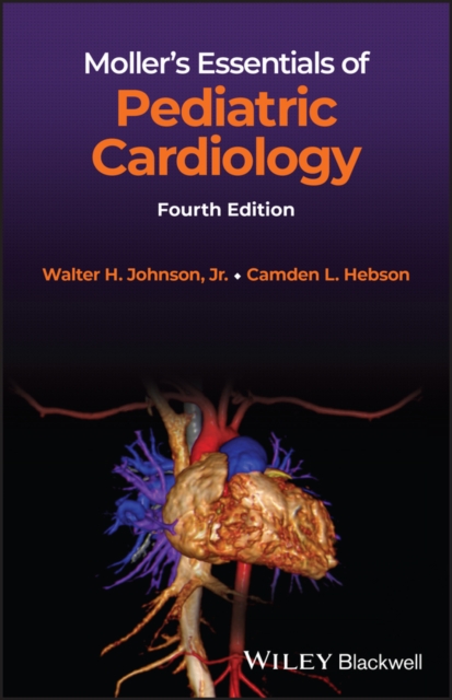 Moller's Essentials of Pediatric Cardiology, Paperback / softback Book