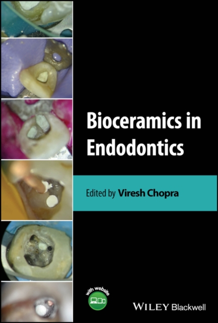 Bioceramics in Endodontics, Hardback Book