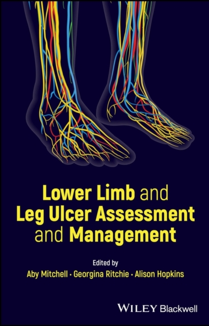 Lower Limb and Leg Ulcer Assessment and Management, Paperback / softback Book