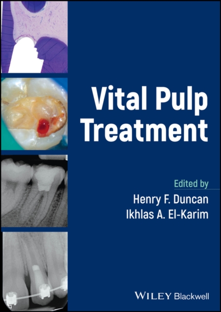 Vital Pulp Treatment, Hardback Book