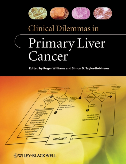 Clinical Dilemmas in Primary Liver Cancer, EPUB eBook