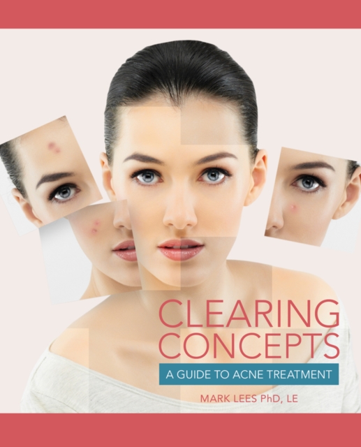 Clearing Concepts : A Guide to Acne Treatment, Paperback / softback Book