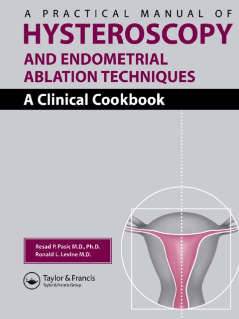 A Practical Manual of Hysteroscopy and Endometrial Ablation Techniques : A Clinical Cookbook, EPUB eBook