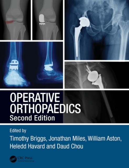 Operative Orthopaedics, Paperback / softback Book