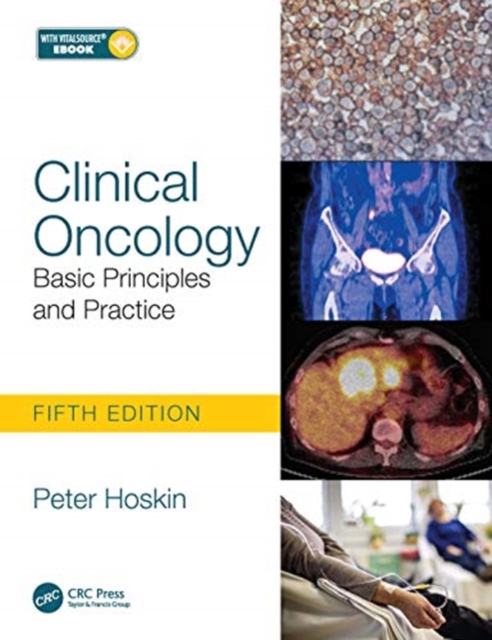Clinical Oncology : Basic Principles and Practice, Paperback / softback Book