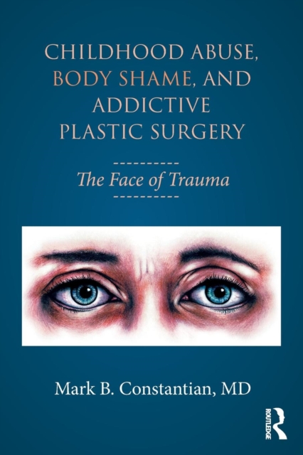 Childhood Abuse, Body Shame, and Addictive Plastic Surgery : The Face of Trauma, Paperback / softback Book