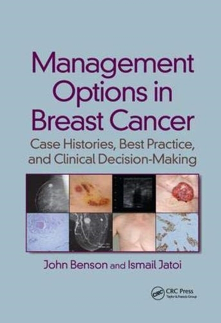 Management Options in Breast Cancer : Case Histories, Best Practice, and Clinical Decision-Making, Paperback / softback Book