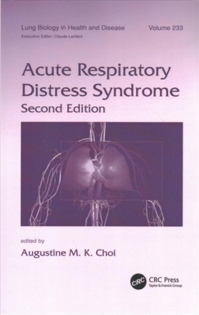 Acute Respiratory Distress Syndrome, Paperback / softback Book