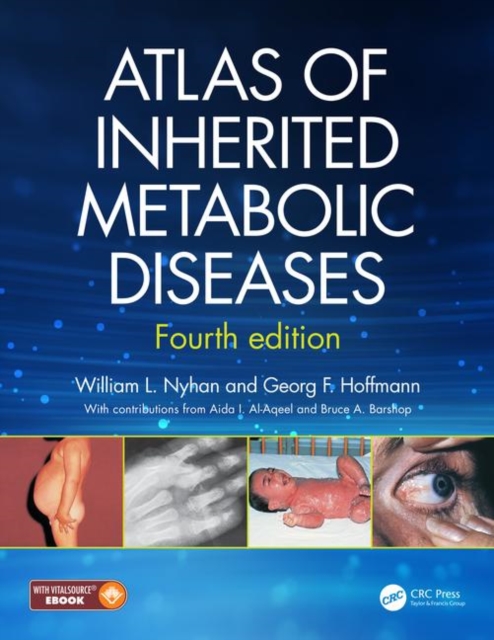 Atlas of Inherited Metabolic Diseases, Hardback Book