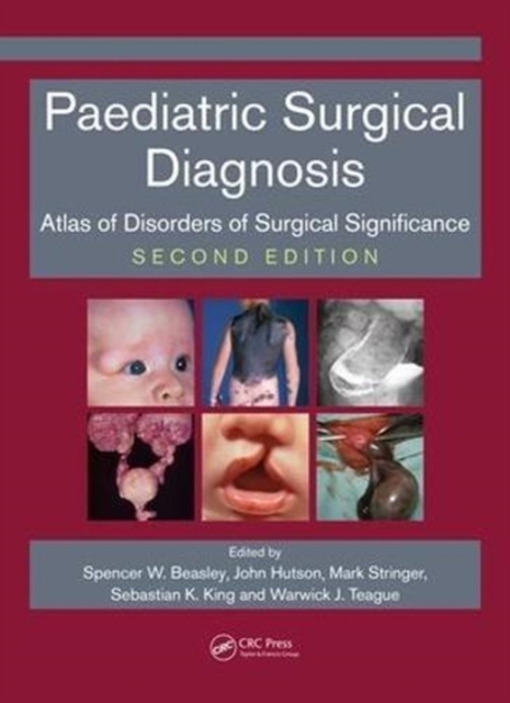 Paediatric Surgical Diagnosis : Atlas of Disorders of Surgical Significance, Second Edition, Paperback / softback Book