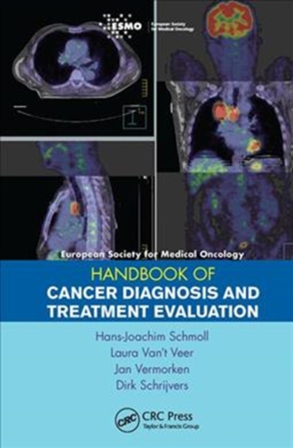 ESMO Handbook of Cancer Diagnosis and Treatment Evaluation, Hardback Book