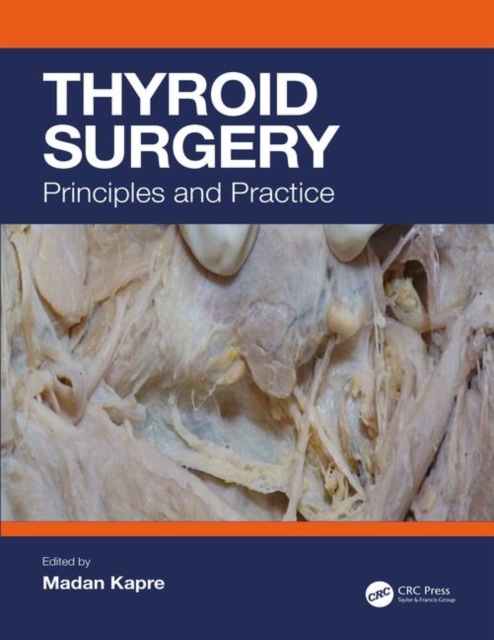 Thyroid Surgery : Principles and Practice, Hardback Book