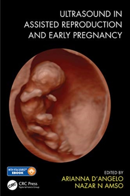 Ultrasound in Assisted Reproduction and Early Pregnancy, Paperback / softback Book