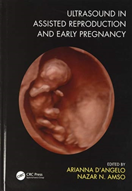 Ultrasound in Assisted Reproduction and Early Pregnancy, Hardback Book
