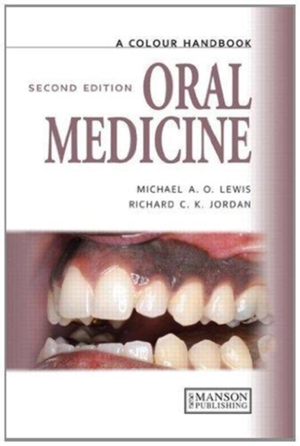 Oral Medicine, Paperback / softback Book