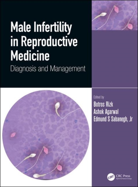 Male Infertility in Reproductive Medicine : Diagnosis and Management, Hardback Book