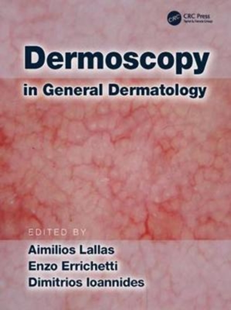 Dermoscopy in General Dermatology, Hardback Book