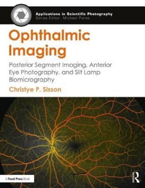 Ophthalmic Imaging : Posterior Segment Imaging, Anterior Eye Photography, and Slit Lamp Biomicrography, Paperback / softback Book