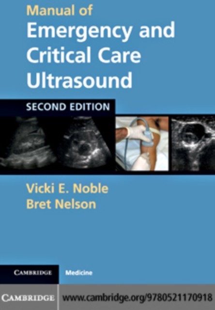 Manual of Emergency and Critical Care Ultrasound, PDF eBook