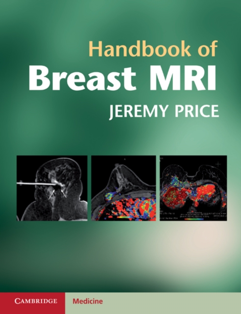 Handbook of Breast MRI, PDF eBook