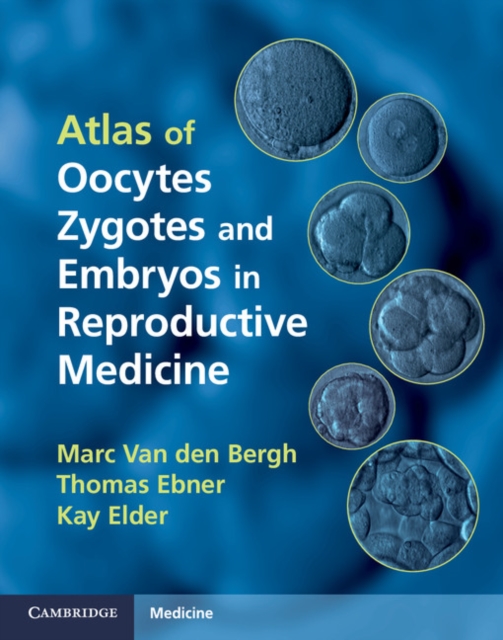 Atlas of Oocytes, Zygotes and Embryos in Reproductive Medicine, PDF eBook