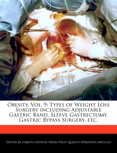 Obesity, Vol. 9 : Types of Weight Loss Surgery Including Adjustable Gastric Band, Sleeve Gastrectomy, Gastric Bypass Surgery, Etc., Paperback / softback Book