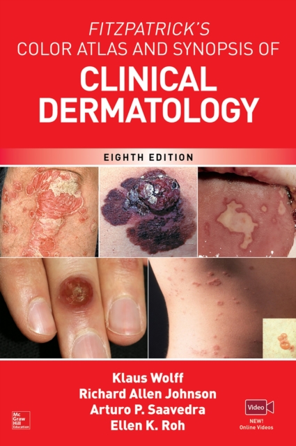 Fitzpatrick's Color Atlas and Synopsis of Clinical Dermatology, Eighth Edition, EPUB eBook