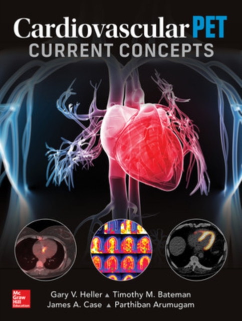 Cardiovascular PET: Current Concepts, Hardback Book