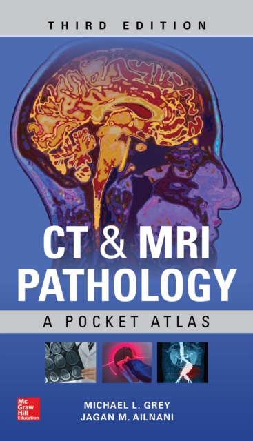 CT & MRI Pathology: A Pocket Atlas, Third Edition, EPUB eBook