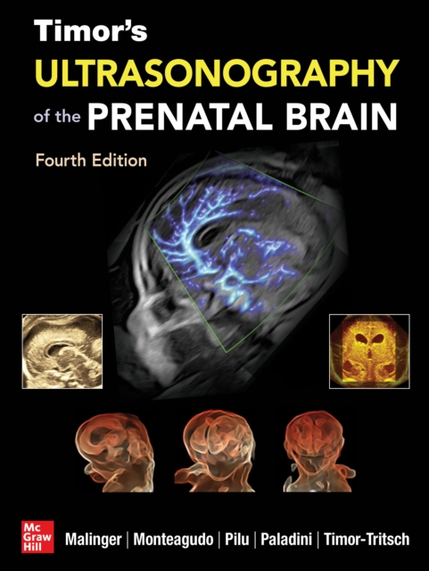 Timor's Ultrasonography of the Prenatal Brain, Fourth Edition, EPUB eBook