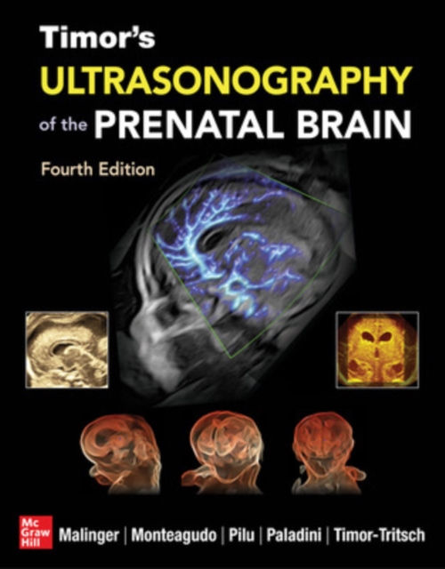 Timor's Ultrasonography of the Prenatal Brain, Fourth Edition, Hardback Book