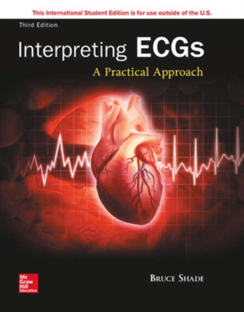 Fast and Easy ECGs ISE, EPUB eBook