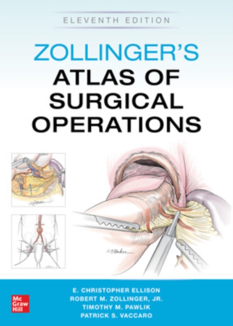 Zollinger's Atlas of Surgical Operations, Eleventh Edition, Paperback / softback Book