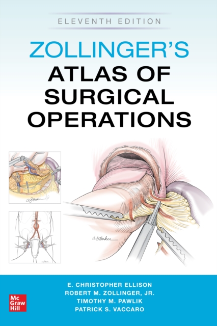 Zollinger's Atlas of Surgical Operations, Eleventh Edition, EPUB eBook