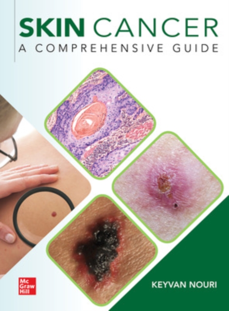 Skin Cancer: A Comprehensive Guide, Paperback / softback Book